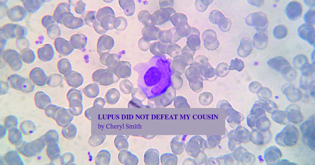 Lupus Did Not Defeat My Cousin (My Truth)